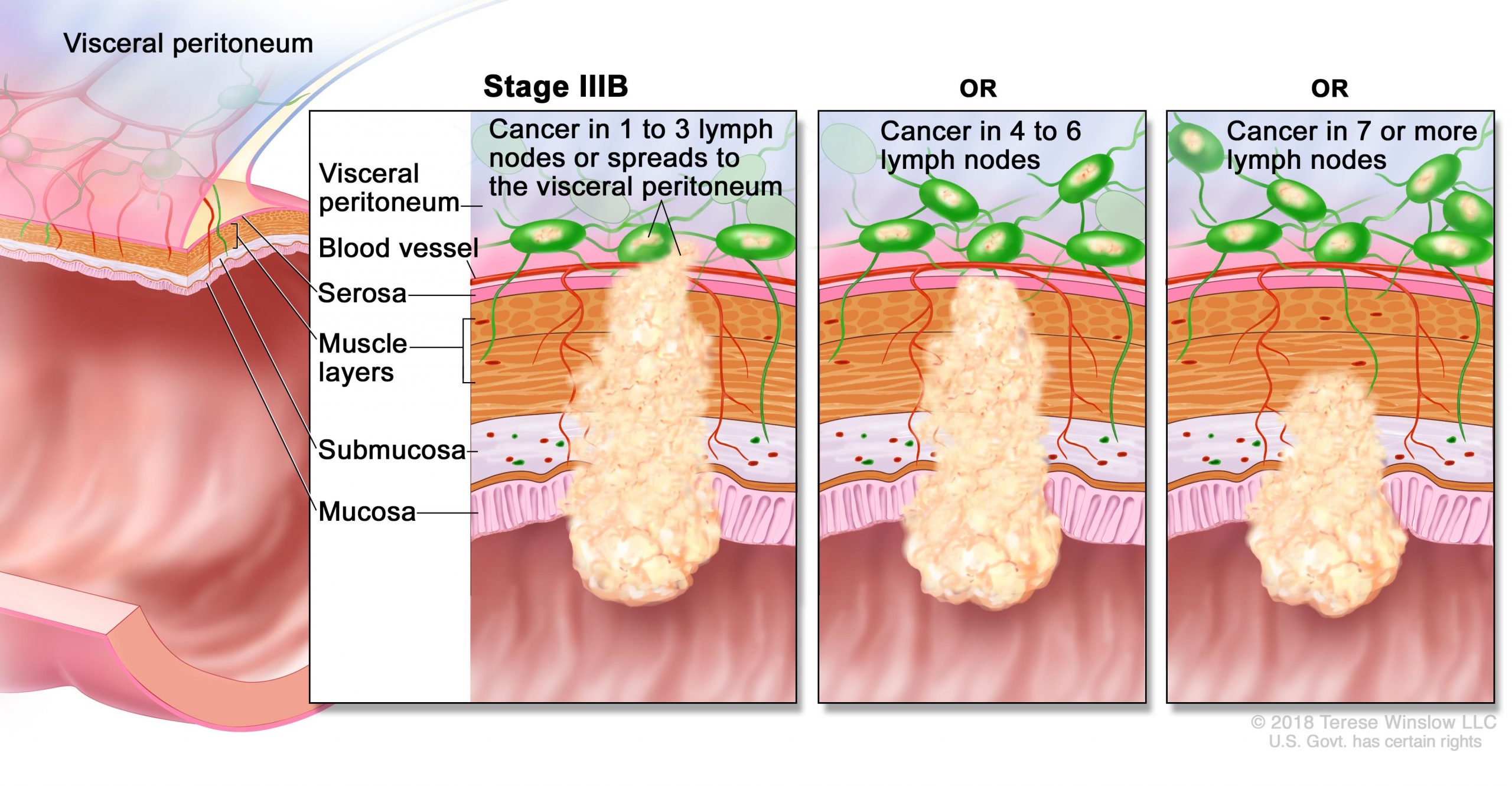 Blood Cancer Prevention