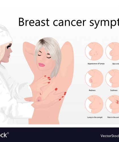 breast-cancer-examination-at-doctor-and-symptoms-vector-20579781