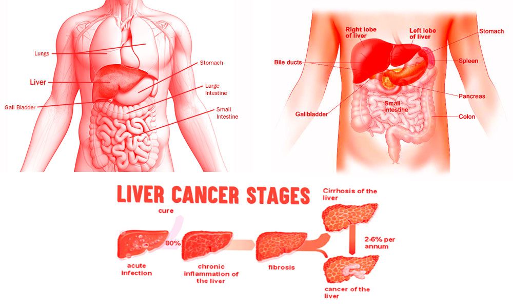 Liver-Cancer-Prevension
