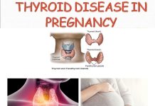 Thyroid problems in pregnancy
